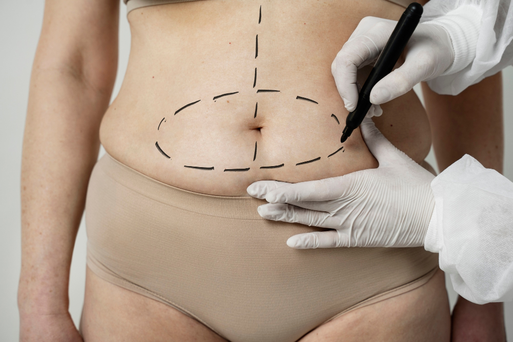 lipo